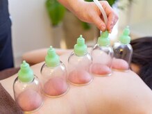 佳園/吸玉カッピング