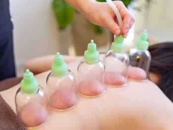 佳園/吸玉カッピング