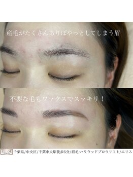 エリス(ELISSE)/ハリウッドブロウリフト