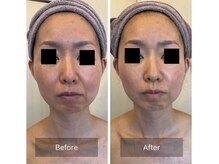 サロン ド カシェット 銀座/お客様のビフォーアフター例