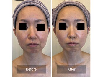 サロン ド カシェット 銀座/お客様のビフォーアフター例