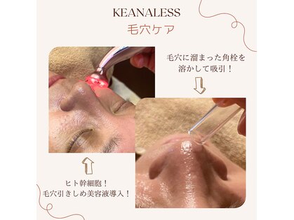 ケアナレス(KEANALESS)の写真