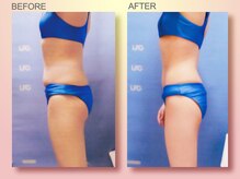 ジュリア オージェ 四条河原町店/ビフォーアフター（ブライダル）