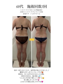 ボヌール/モニター様(60代)