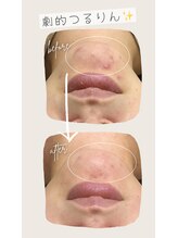 ル ルポ(Le repos)/繰り返し悩みに！