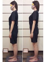 三輪整体院 鍼灸マッサージ院/姿勢・骨盤矯正の1回目の変化
