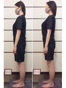 三輪整体院 鍼灸マッサージ院/姿勢・骨盤矯正の1回目の変化