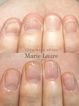 マリーロール 淀屋橋本店(Marie Laure)/自爪育成/深爪矯正/ネイルケア