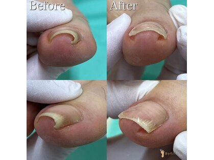 巻き爪補正店 西宮北口店の写真