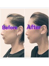 フェイス 本店 盛岡岩手(FACE)/