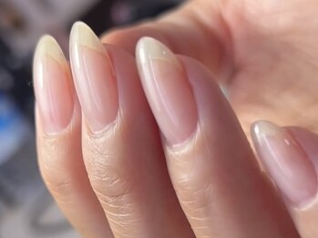 ソラニワ(soraniwa)の写真/爪が薄い・弱い、形に悩みがある方必見◎爪の健康を第一に考えた施術で、健康に自爪をケア♪
