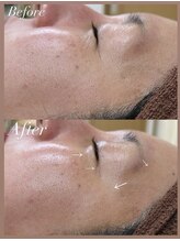 コーラル(CORAL)/30代*小顔リンパフェイシャル*