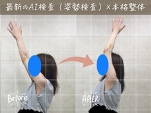 ナオル整体 町田院(NAORU整体)/before/after【10】 町田/整体