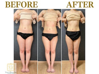 ヴェールブランシュ 町田(Vert Blanche)/#ブライダルエステ#痩身#くびれ