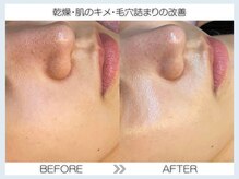 フェアリー(fairy)/