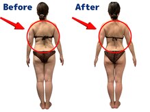 ワクワクボディクリニック 鶴ヶ峰店(WAKUWAKU BODY CLINIC)/背中も激変！