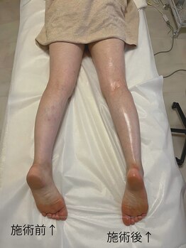 コア(Coeur)/最新マシーン★神の手ウルトラ