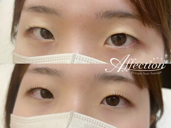 アフェクション アイビューティー(Affection eye beauty)/まつげパーマ
