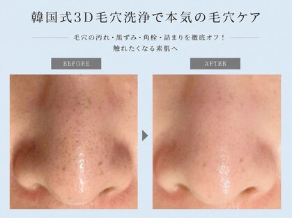 ヴィヴィッド(vivid)の写真