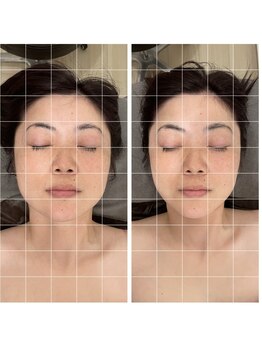 ジーニー(Genie)/「変化」のある小顔