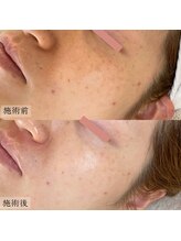 ソワ(soie.)/【韓国肌管理】ララピール