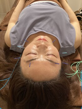 ハリファ鍼灸院 横浜関内院(HariFa鍼灸院)/美容施術/美容鍼