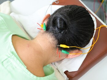 キュアハンズ 大森の写真/【EMS×美容鍼】本格お肌のメンテナンス！たるみケアに◎若々しい見た目を手に入れられます♪