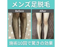 髭ラボ(髭LABO)の雰囲気（男性特有の濃い体毛・毛量のお悩みも細やかにご対応可能）
