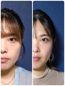 ぐっすりん/複数回継続のお客様の変化(1)