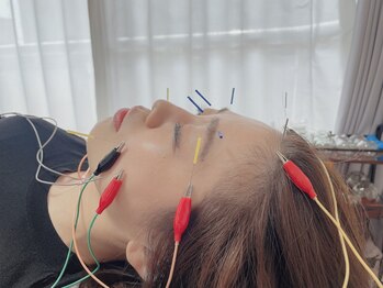 ハリトト鍼灸院/美容鍼灸 通電使用