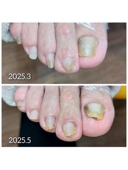 爪切り屋 足楽/