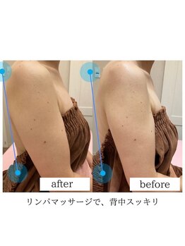 ミーティスジータ(mitis Gita)/リンパマッサージ