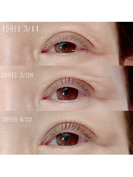 オッターヴァ 学芸大学(8va.)/マイラミネーション（マツパ）