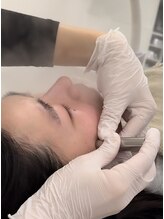 マホロバ(mahoroba)/最新美容鍼ダーマ鍼で肌改善