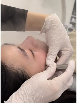 マホロバ(mahoroba)/最新美容鍼ダーマ鍼で肌改善