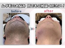 ネクストプラス 大分別府店(NEXT+)