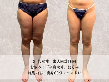 エクストリミティ 国立店(EXTREMITY)/お客様の変化