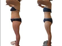 アンドゥ 津田沼(Undo)/50代からの痩身