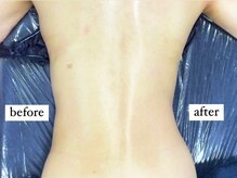 サロン ド カシェット 銀座/結果にこだわっている施術！