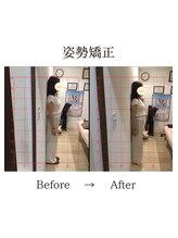 心斎橋長堀フェムテック整骨院/44姿勢矯正　骨格矯正と骨盤矯正