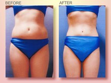 ジュリア オージェ 四条河原町店/ビフォーアフターエンダモロジー