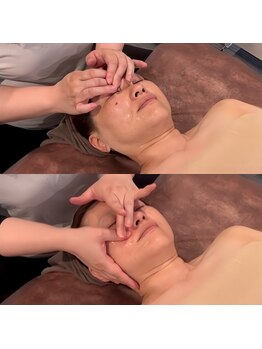 ハピネス(HappIness)/小顔矯正施術中