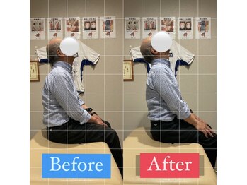 ナオル整体 宮崎院(NAORU整体)/50代男性施術事例【猫背姿勢】