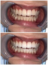 ライトビューティー 池袋店(LightBeauty)/症例写真