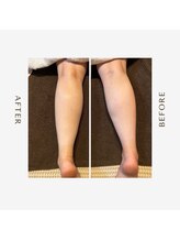 レーヴ(Reve)/血行促進！！