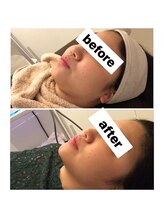 フェイス 本店 盛岡岩手(FACE)/