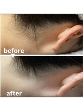 メゾン ド クロエ(Maison de Chloe)/ブライダルシェービング