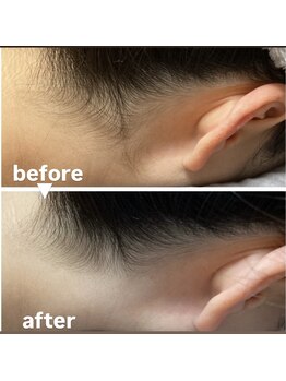 メゾン ド クロエ(Maison de Chloe)/ブライダルシェービング