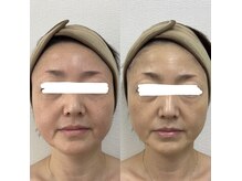 エムアンド(M&)の雰囲気（1箇所3分!速攻で小顔が手に入ります。お悩み改善していきます）