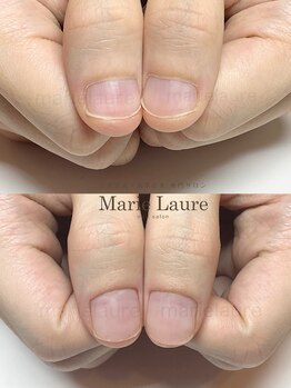 マリーロール 淀屋橋本店(Marie Laure)/深爪矯正/自爪育成/ネイルケア